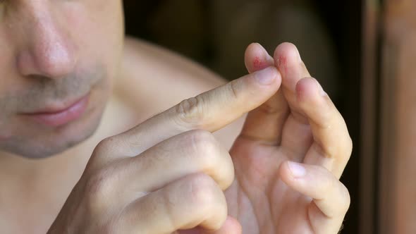 Sad Unhappy Man Suffering Pain Touching His Injured Fingers on Hand