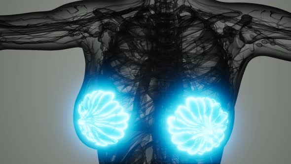 Medical Scan of Woman Breast Cancer alt