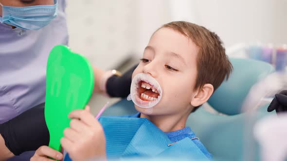 Funny Little Boy Having a Treatment in the Dentistry with an Opening Mouth Guard