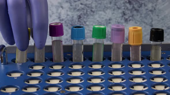 Plastic test tubes with caps for the collection of samples. Test tube rack. Medical modern medicine