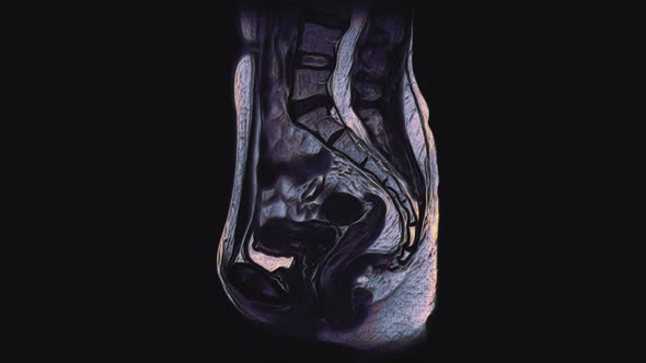 Bulk Multicolored MRI of the Female Pelvic Organs, Abdominal Cavity, Gastrointestinal Tract and