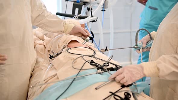 An Assistant Assists the Surgeon with the Operation Laparoscopic Appendectomy