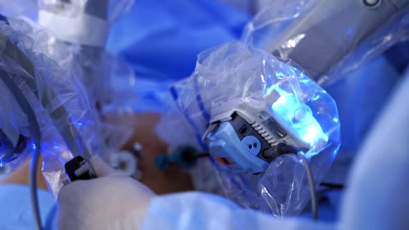 Robotic arms doing a surgery