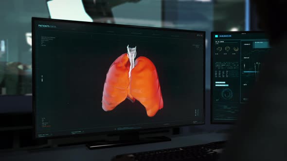 Human's Lungs Shown In 3D Animation To Be Analyzed In Modern Medical Software