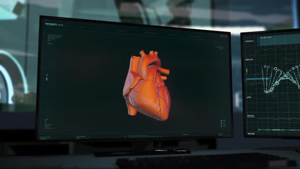 Interface of the examination software identifying Cardiac Ischemia disease alt