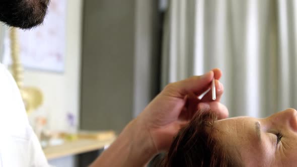 Physiotherapist giving acupuncture treatment to female patient