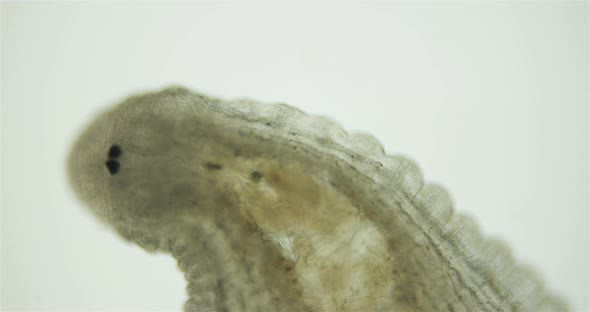 Leech Family Glossiphoniidae Under a Microscope