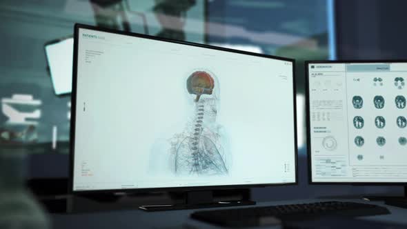 Diagnostic software is scanning the human brain at the modern medical laboratory alt