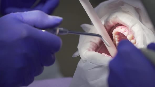 Dentist Conducts Dental Hygiene To the Patient