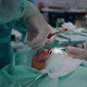 The Doctor Performs a Pediatric Surgical Operation to Remove the Tonsils - VideoHive Item for Sale