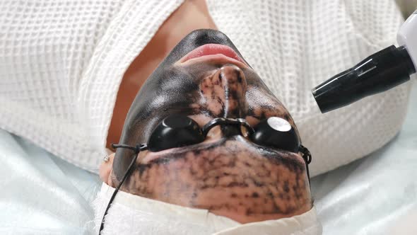 Cosmetologist Making Carbon Face Peeling Procedure. Laser Pulses Clean Face Skin. Hardware