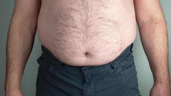 An overweight man cannot hold in his stomach anymore. Bulging belly.