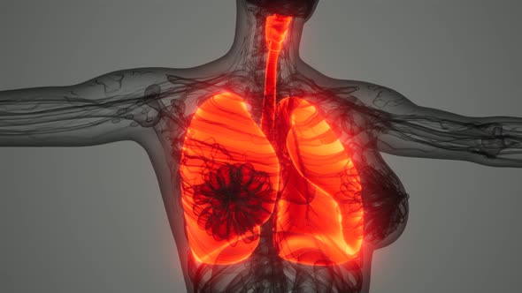 Human Lungs Radiology Exam alt