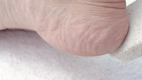 close up of women's heels holding a pumice stone, with brush on the other side.girl using natural