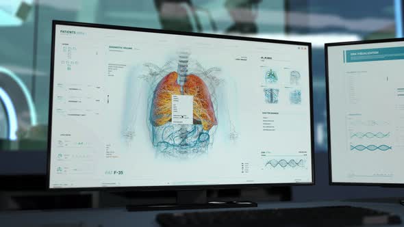 Finding the Particles of Covid-19 Virus after Scanning the Patient`s Lungs alt