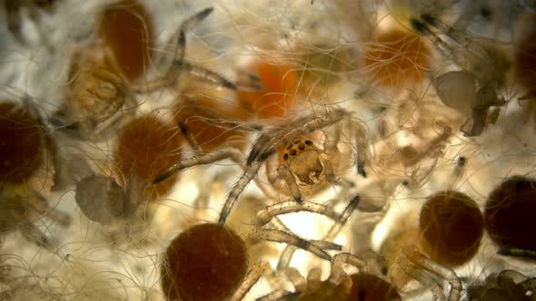 Spider under a microscope, Arachnida class