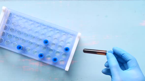 Hand in Blue Medical Gloves Holding Blood Test Tube