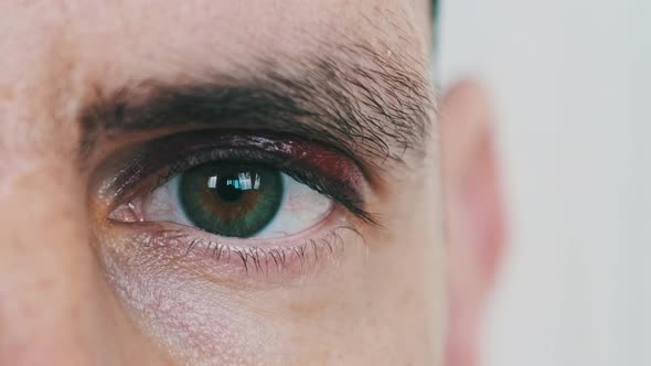 Bruise Over the Eye of a Man Closeup