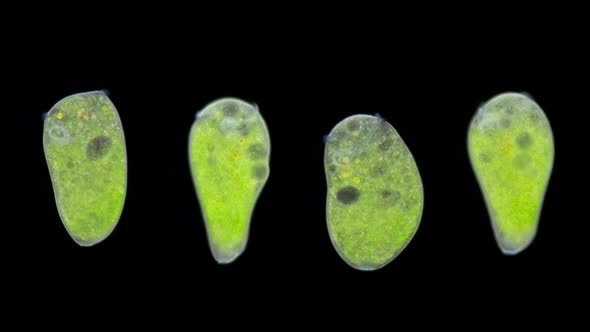 Infusoria Stentor Under the Microscope