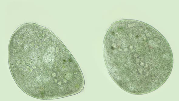 Ciliary Infusoria Under a Microscope