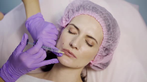 A beautician in gloves makes botox injections to the upper and lower parts of the lips