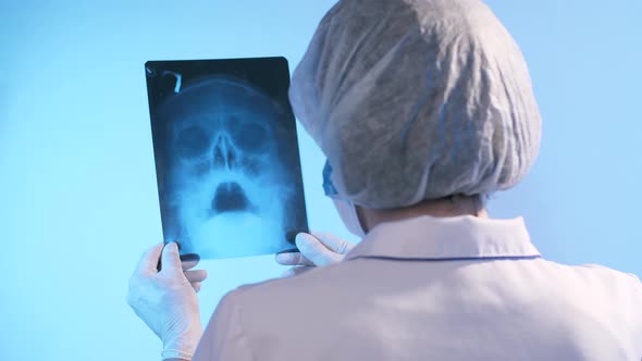 Physician Looks at X-ray of the Skull