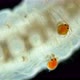 Larva mite Hydrachnidia and Hydrophilidae larva under a microscope - VideoHive Item for Sale
