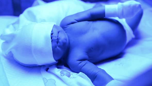 Newborn Having a Treatment for Jaundice Under Ultraviolet Lamp in Home Bed