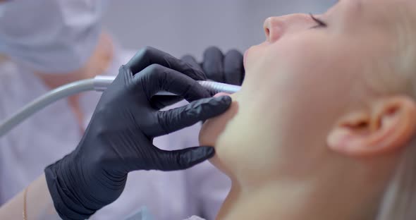 Dentist in Black Gloves Works with a Drill in the Patient's Mouth Treatment of Caries