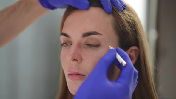 Closeup Hand in Gloves Marking Dots for Beauty Injections on Female Face