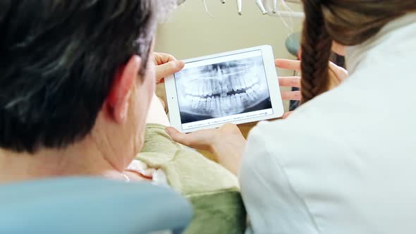 Close up back view of dentist showing X-ray of teeth on tablet to patient