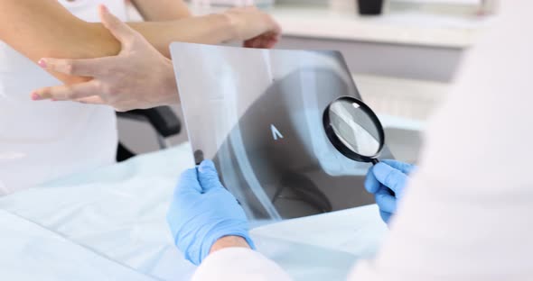 Doctor Examines Xray of Elbow Pain Slow Motion  Movie