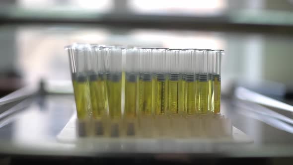 Flasks with a Yellow Medical Preparation on a Stand in a Chemical Laboratory