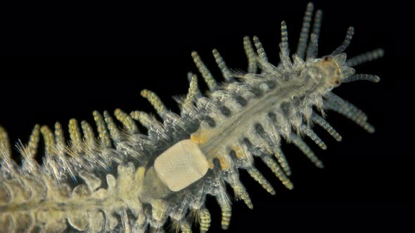 a Sea Ciliary Worm of the Syllidae Family Under a Microscope, Differs in Others By the Presence  alt