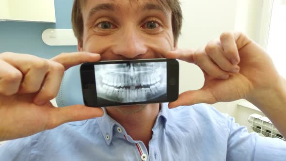 Close up of man holding smartphone with photo of dental X-ray at dentist