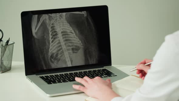 Doctor Veterinarian Examining Hedgehog Skeleton Roentgen on Laptop Computer