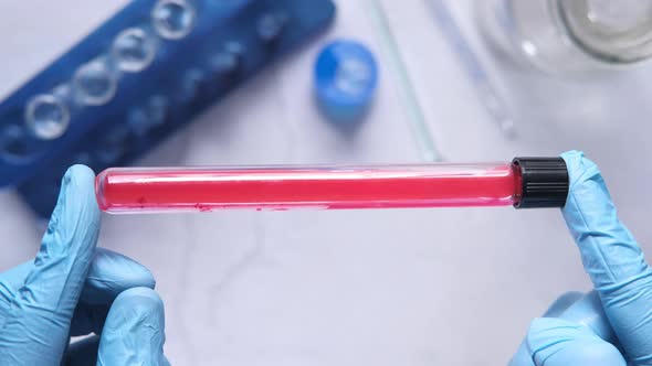 Laboratory Technician Hand Holding Blood Test Tube 