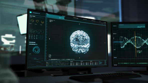 MRI Scanning system has identified the Brain Tumor in the studied human subject alt