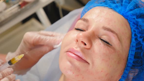 Modern Beauty Invasive Procedure on Face