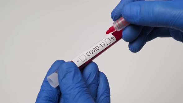 Positive Result of COVID-19 Test. Medical Worker Holding Testing Blood Sample