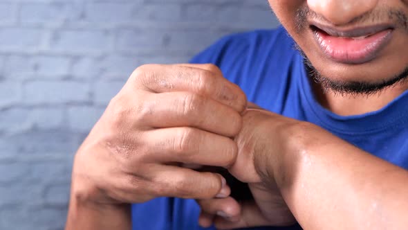 Man Suffering From Itching Skin, Close Up.