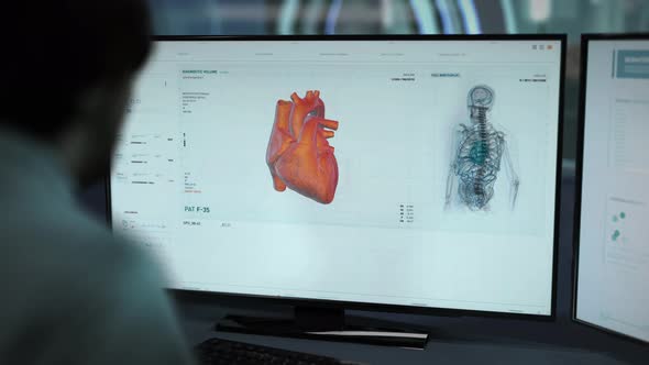 Modern scanner has diagnosed a patient with myocardial ischemia heart disease alt