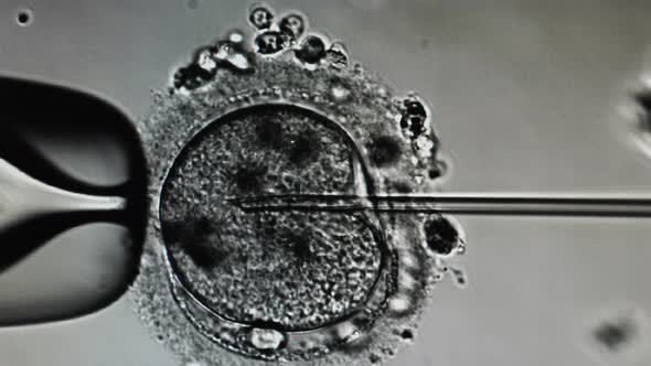 Intracytoplasmic Sperm Injection. Microscope View of in Vitro Fertilization. Embryologist Performing