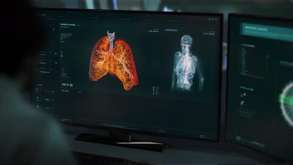 Examination system identifies the cancer disease cell in the patients lungs alt