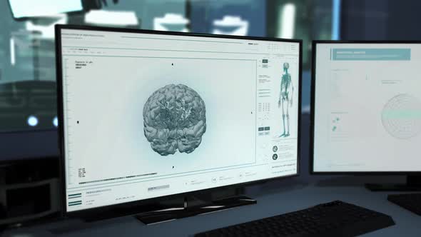 Oncological Software Interface Checks Patients Brain Health Data Analysis alt