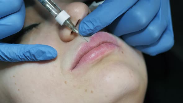 Beautiful Woman Getting Lip Augmentation Injections at a Cosmetology Appointment