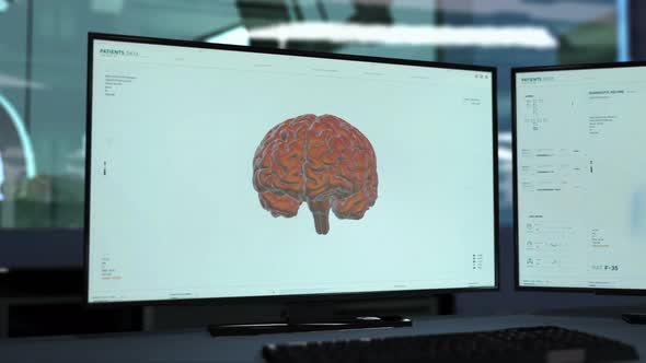 Patients Brain Analysis In Medical Laboratory Futuristic Radiology Scan Device alt