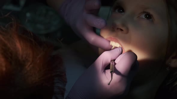 Woman Dentist examines the girl's teeth in the clinic. a little girl in a dental chair.