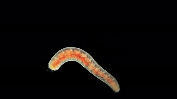 Oligochaeta Worm Under a Microscope, Type Annelida, Sample Found at Lake Baikal