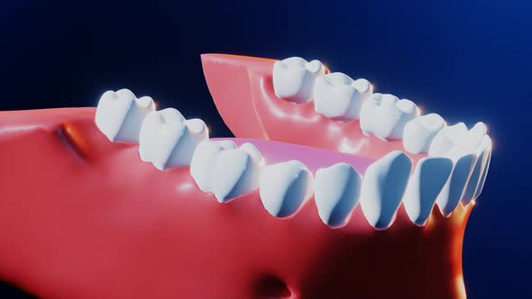 Tooth Medical Dental Implant Process